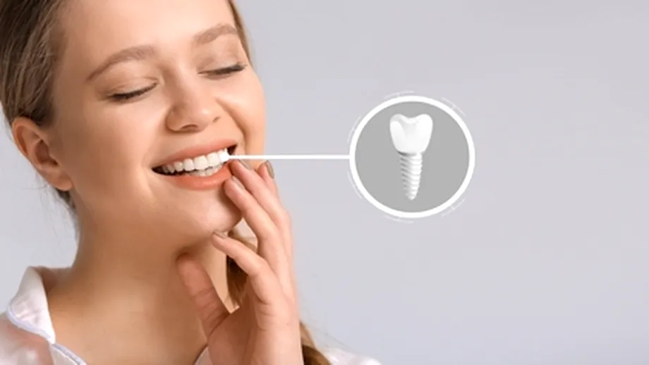 (P) All-on-X: soluția modernă pentru pacienții cu pierderi masive de dinți