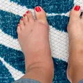 Semnele ascunse de pe picioare care pot indica probleme grave de sănătate. La ce trebuie să fii atent