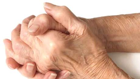 Probleme cu care se confruntă bolnavul de artrită reumatoidă
