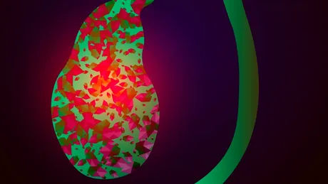 Dischinezia biliară: simptome, cauze, analize, tratament, prevenţie