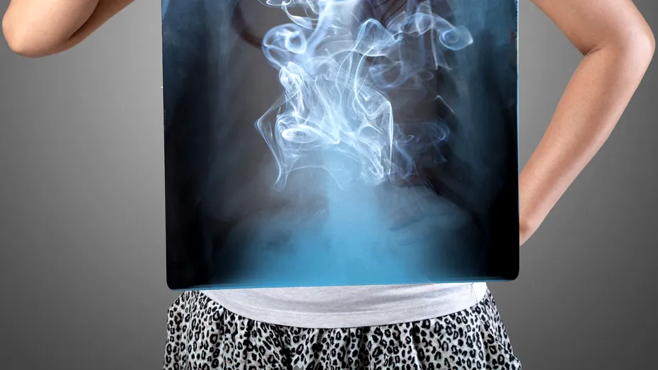 6 părţi ale corpului pe care ţi le distruge fumatul