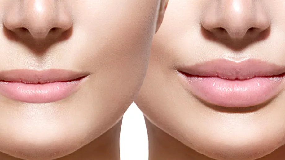7 lucruri pe care trebuie să le ştii despre mărirea buzelor