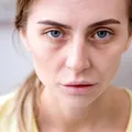 Medic cardiolog, despre fenomenul „Ozempic face”: „Slăbirea rapidă poate distruge organismul”