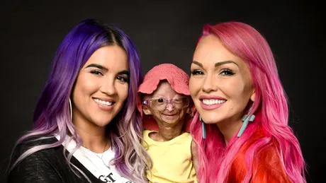 Fetița cu cea mai rară boală genetică, a murit la 15 ani. Era faimoasă pe Youtube