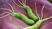 Cum se depistează infecția cu Helicobacter Pylori și ce regim se recomandă? Răspunde dr. Tatiana Popescu