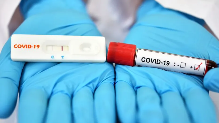 Testele rapide pentru COVID-19, orientative. Singurul test validat de OMS este testul RT-PCR
