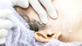 Colegiul Medicilor investighează medicul estetician din București, după ce o pacientă venită pentru lifting a ajuns în comă și a murit / VIDEO