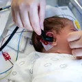 Screeningul pentru deficiențe de auz la bebeluși. Testul simplu care poate schimba întreaga viață a unui copil