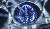 Cum a descoperit Anton, un copil de 12 ani, că avea o tumoră cerebrală gigant. Medicii de la Botoșani l-au transferat de urgență la Spitalul din Iași