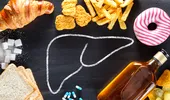 Alimente aparent inofensive care îți pot afecta ficatul. Le consumi zilnic!