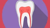 Scoaterea nervului dintelui: când este necesară