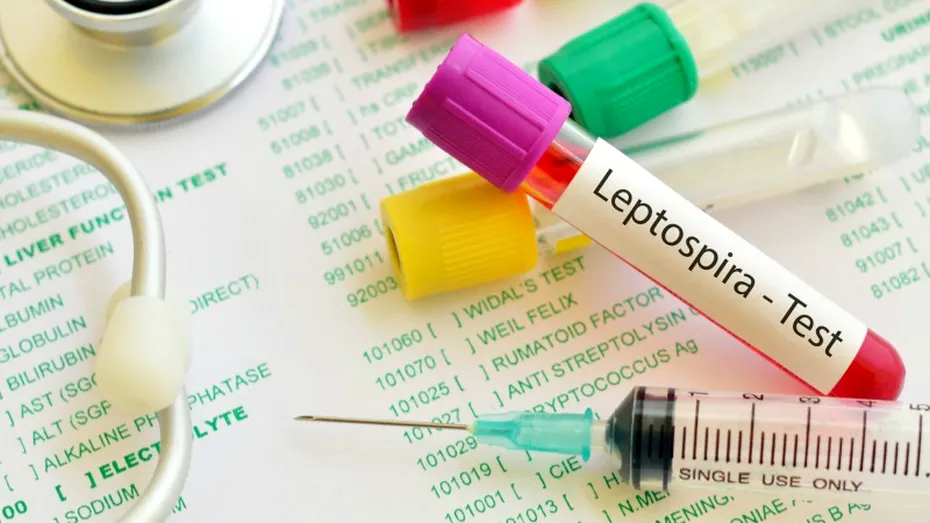 Leptospiroza: simptome, tratament