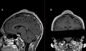 Când au văzut radiografia asta, medicilor nu le-a venit să creadă. Ce a păţit un bărbat după ce s-a învârtit în cap