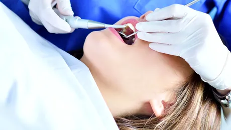 5 remedii naturale pentru gingivită