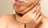 De ce apare bărbia dublă? Ține de kilogramele în plus sau o pot avea și persoanele slabe?