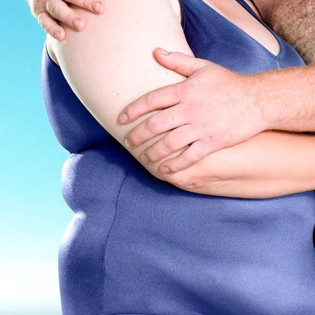Infertilitatea și obezitatea – bărbații nu au material seminal de calitate, femeile riscă să dezvolte complicații în sarcină