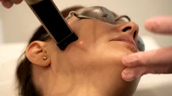 Lifting optim, fără chirurgie, procedura cu recuperare rapidă pe care tot mai multe femei o aleg