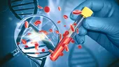 Test revoluționar pentru cancerul pancreatic asimptomatic: acuratețe de 97% și speranțe pentru depistarea bolii în stadii incipiente