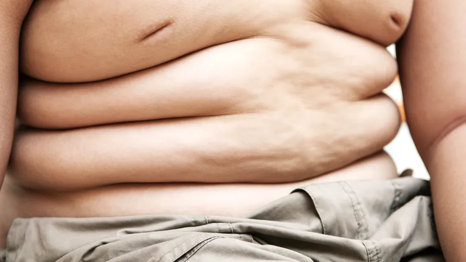 Academia Americană de Pediatrie recomandă medicamentele de slăbit la copiii cu obezitate, pe lângă dietă și mișcare. Medic: „Așteptarea nu funcționează”