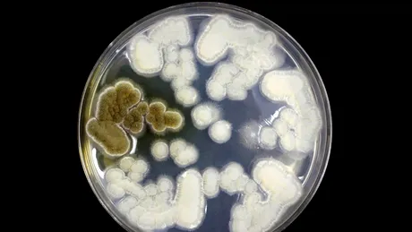 Ce este Candida Auris (Candidozyma Auris)? Ciuperca rezistentă amenință spitalele din întreaga Europă