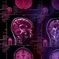 Tremorul mâinilor, problemele de memorie sau schimbările de comportament pot ascunde afecțiuni neurologice. Ce semnale nu ar trebui ignorate