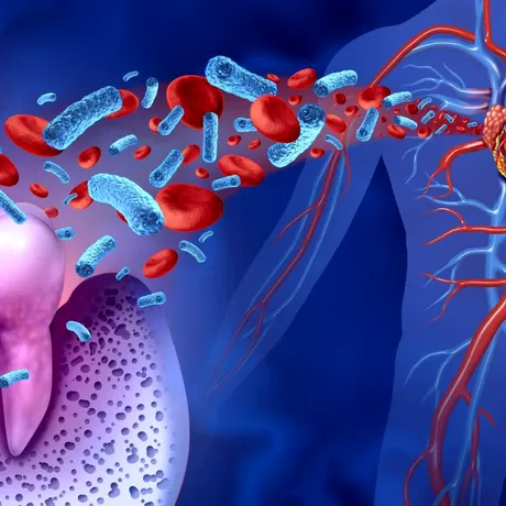 Afecțiunile cardiovasculare pot grăbi pierderea dinților! Dr. Ionuț Leahu: „Nu începem cu implantul dentar, începem cu pacientul”