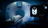 Ce au descoperit medicii când i-au făcut un CT unui bărbat în vârstă de 70 de ani