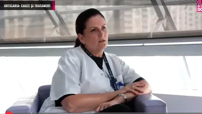 Urticaria: cauze și tratament