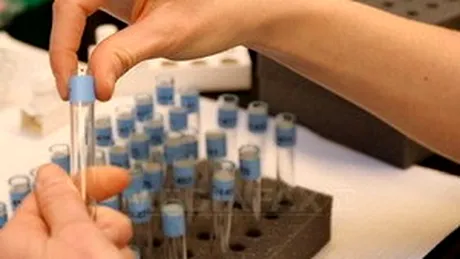 Un test de saliva pentru depistarea cancerului, creat de cercetatori