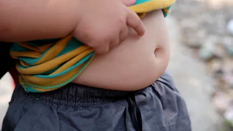 Cercetătorii au reușit să prezică obezitatea la copii folosind sânge din cordonul ombilical