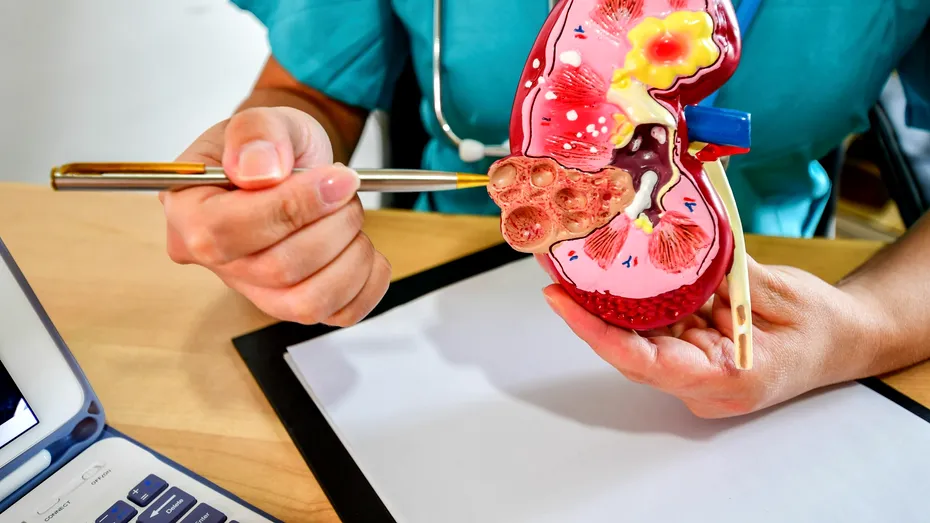 Băutura IEFTINĂ care reduce riscul de insuficiență renală acută. Românii o adoră!