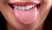 Ce spune culoarea limbii despre starea ta de sănătate