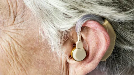 STUDIU. Purtarea unui aparat auditiv poate întârzia simptomele demenței