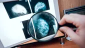 14 mituri și adevăruri despre cancerul mamar