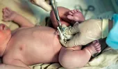 Clamparea întârziată a cordonului ombilical și recoltarea de celule stem la naștere: beneficii pentru bebeluș și pentru mamă