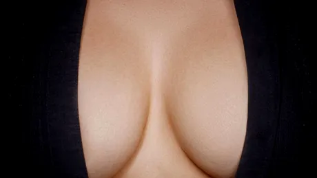 Implanturi mamare: ce implica operatia