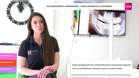 Cum se tratează parodontoza explică dr. Diana Ionescu