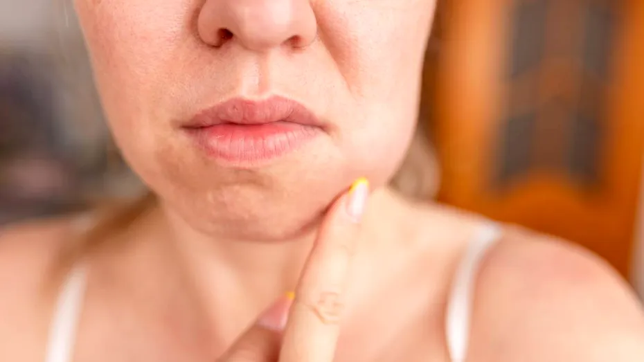 Ce se întâmplă cu dinții și gingiile în timpul menopauzei. Explicațiile medicului stomatolog