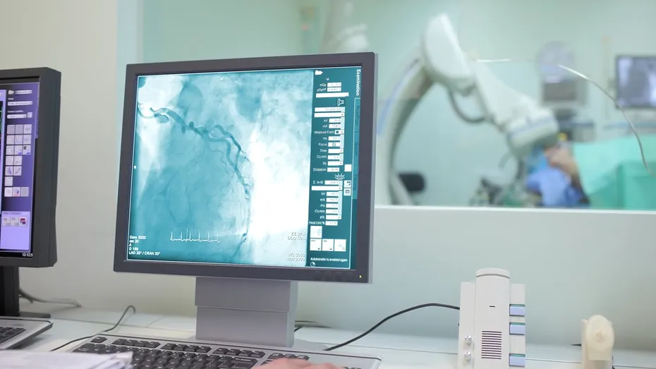 (P) Când ajungi la coronarografie: semnele care arată că nu mai este suficient doar un control de rutină