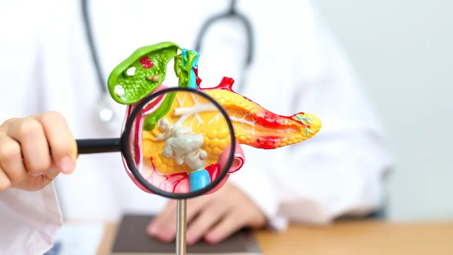 Un singur pahar de bere pe zi poate crește riscul de cancer pancreatic? Ce spun cercetările despre legătura dintre alcool și una dintre cele mai agresive boli