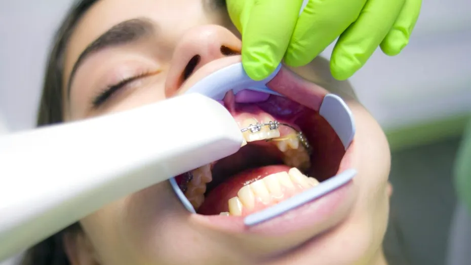 Inovații în tratamentul ortodontic. De la diagnostic la aparate dentare care reduc durata de tratament cu minimum șase luni