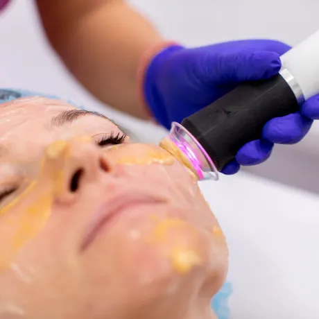 Rejuvenare facială în două etape: cum funcționează un protocol pentru revitalizarea tenului