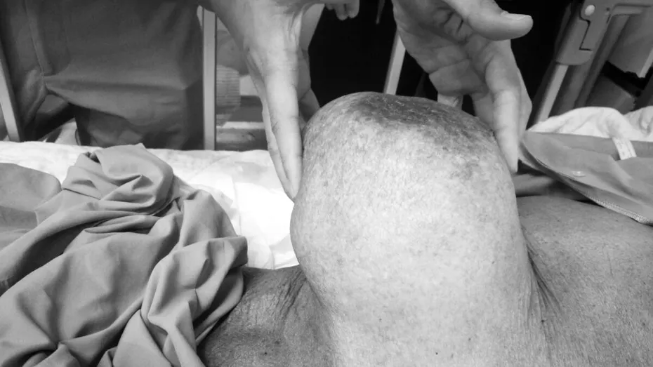 Diagnosticul pe care l-a primit o femeie de 56 de ani. Medicii s-au crucit când au văzut așa ceva: „Operația mi-ar fi fatală”