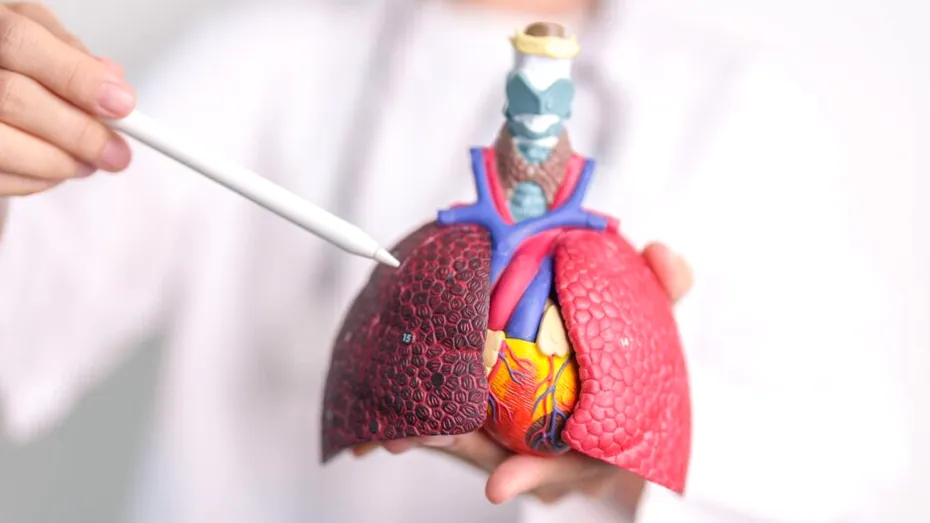 Cancerul pulmonar nu afectează doar fumătorii. Medicul explică factorii de risc pe care mulți îi ignoră