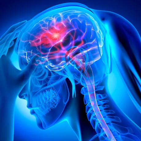 Atenție! Băutura „populară” asociată cu un risc mult mai mare de demență și accident vascular cerebral