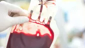 Ce boli riști în funcție de grupa de sânge. Persoanele predispuse la cheaguri de sânge