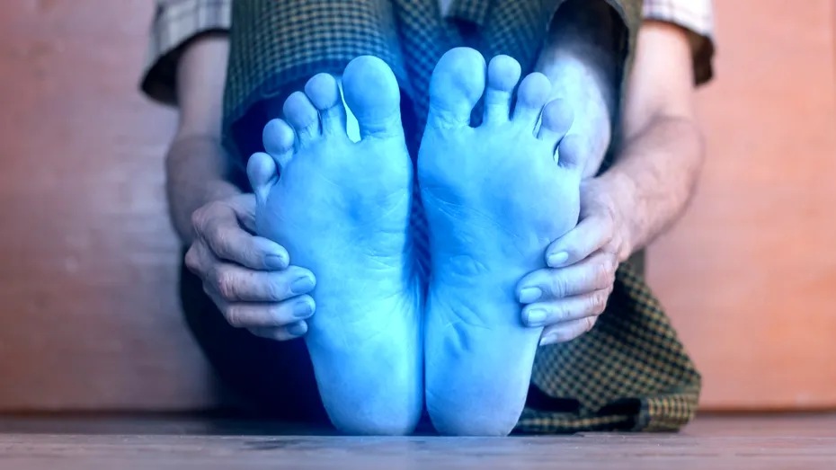 Picioare reci constant? Alimentul simplu care îmbunătățește circulația în câteva zile