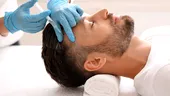 PRP: O abordare în tratamentul alopeciei! Cum se procedează și ce rezultate are