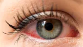 De ce boli oculare suferă românii?