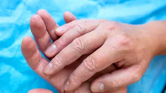 Un semn discret la vârful degetelor poate avertiza asupra unor boli pulmonare grave. Medicii explică ce trebuie să observi